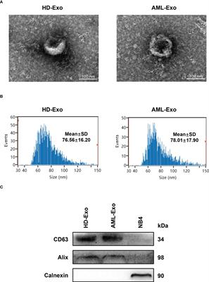 Circulating plasma exosomal long non-coding RNAs LINC00265, LINC00467, UCA1, and SNHG1 as biomarkers for diagnosis and treatment monitoring of acute myeloid leukemia